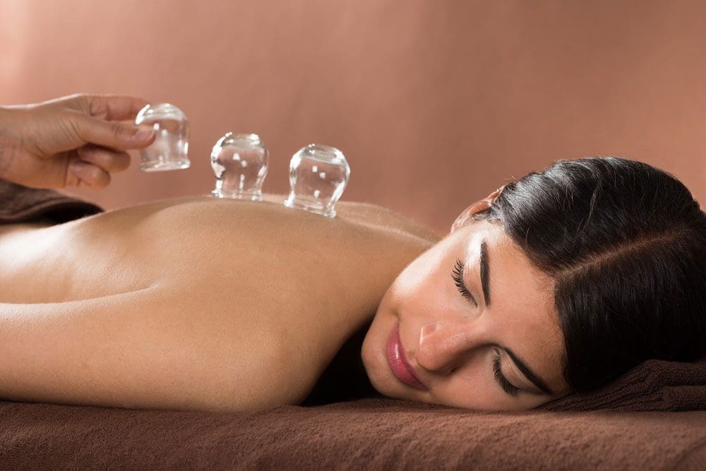 A woman is relaxed while getting cupping therapy.