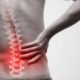 Chiropractic Care for Back Pain – Common Questions