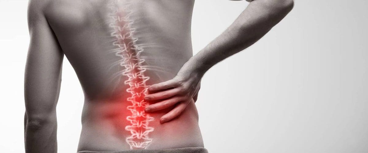 A man rests his hand on his lower back, due to back pain. An artists rendition of the spine is on top of the image, showing spinal misalignment that causes back pain.