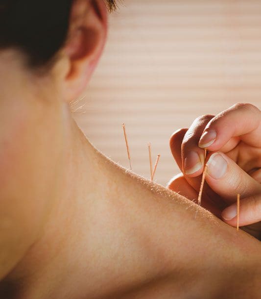 Acupuncture is being applied to a woman's neck.