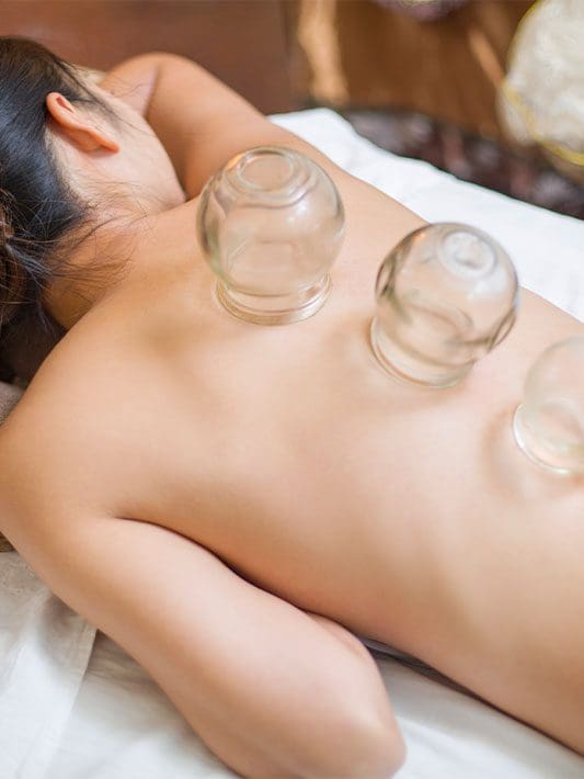 A woman is lying on her stomach with Cupping cups on her back.