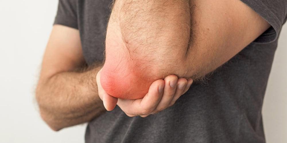 A man is suffering from bursitis of the elbow.