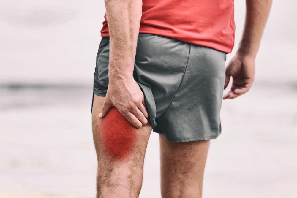 A man in running shorts is in pain because he injured his hamstring. 