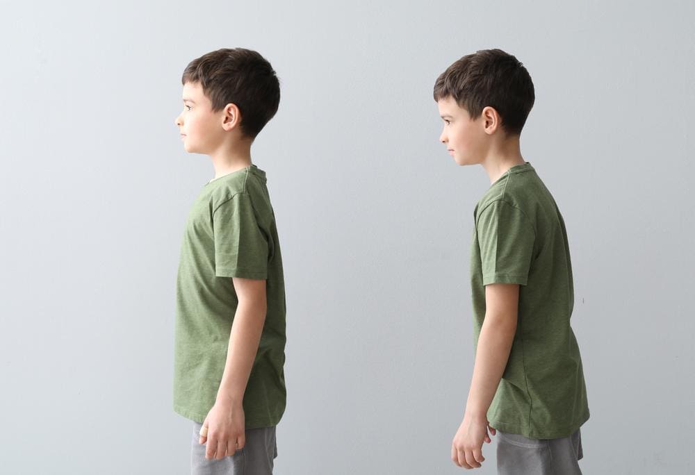 A young boy stands in profile in two images. In the first image he demonstrates good upright posture. In the second image, the boy has poor posture. 
