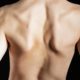 Chiropractic Care After Scoliosis Surgery
