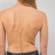 Chiropractic Care for Scoliosis - Treatments and Benefits