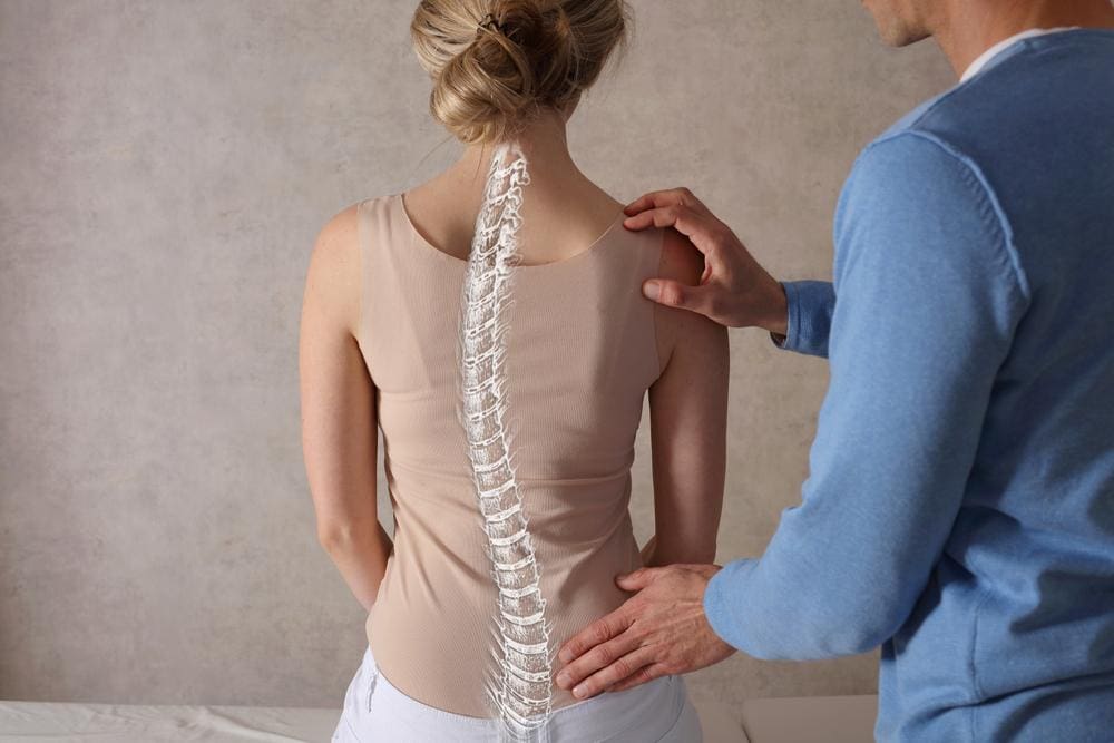 An image of the spine is overlaid on a woman's back to demonstrate her scoliosis. 