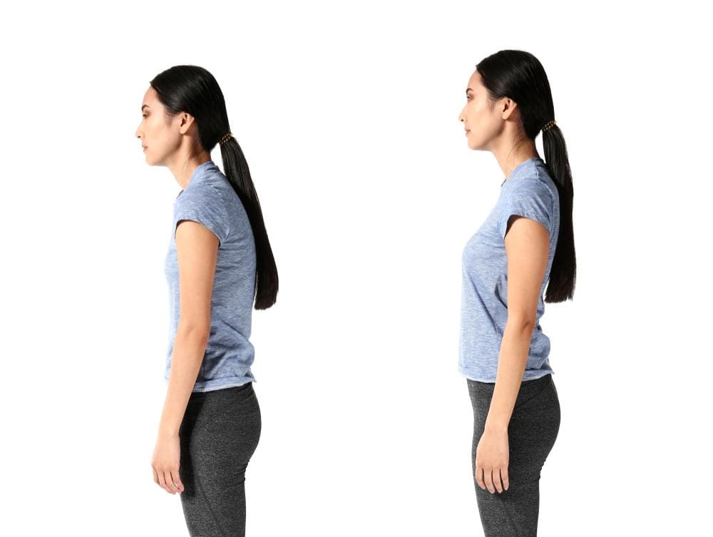 Two images of the same woman standing in profile. In one she has good posture. In the other she has swayback.
