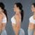 Correcting Swayback Posture with Chiropractic Care