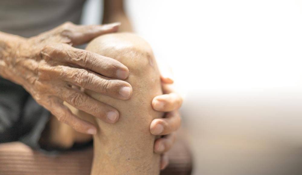 An elderly man is holding his knee because of the pain from knee arthritis. 