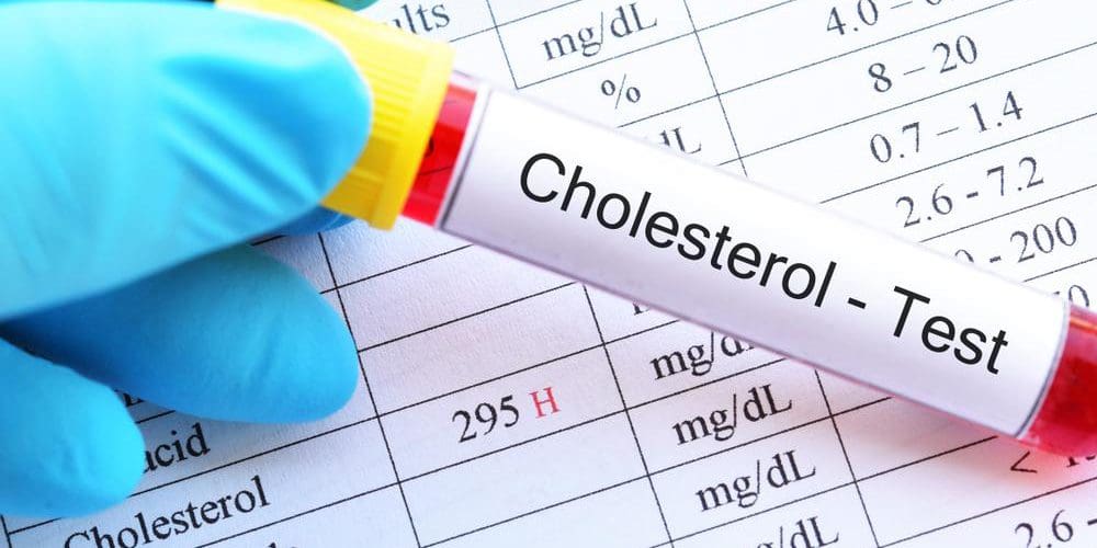 A cholesterol test.