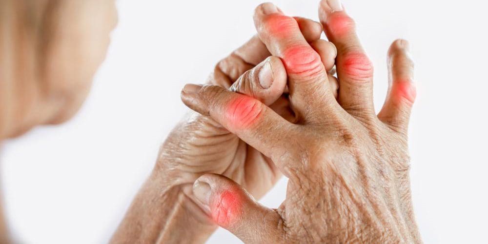 A woman is suffering from gout pain in her hands.