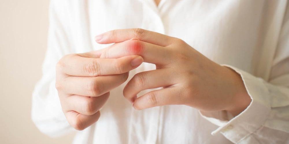 A young woman with lupus is suffering from joint pain in her finger.