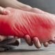Chiropractic Care for Neuropathy
