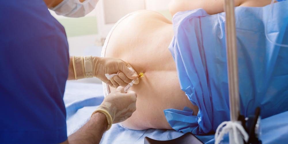 Patient receiving epidural injection inthe spine for back surgery.