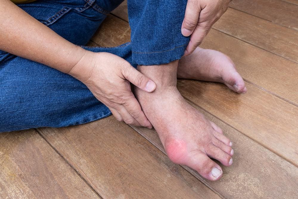 A man with foot pain caused by gout, is sitting on floor. 
 