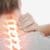 Chiropractic Care for Bulging Cervical Discs