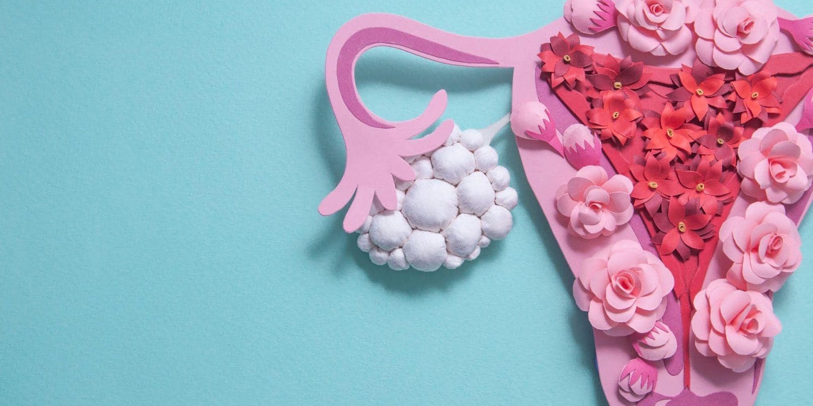 A paper flower sculpture representing polycystic ovaries and a uterus